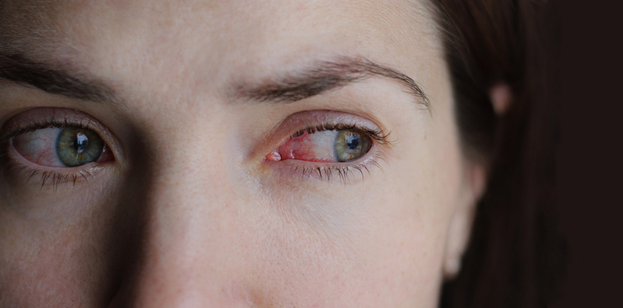 Suché oko: digitální únava může skončit zánětem i „zákazem líčení“