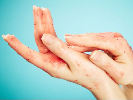 jak pečovat o ruce v zimě - udělejte si peeling